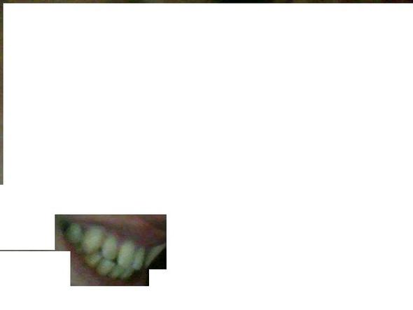 zahn - (Zähne, Zahnarzt, Zahnspange)