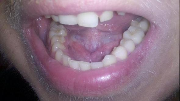 Zahn1 - (Zähne, Zahnarzt, Zahnspange)