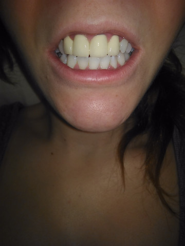 Zähne... - (Aussehen, Zähne, Zahnarzt)