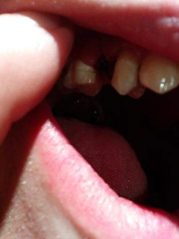 Wunde - (Zähne, Zahnarzt)