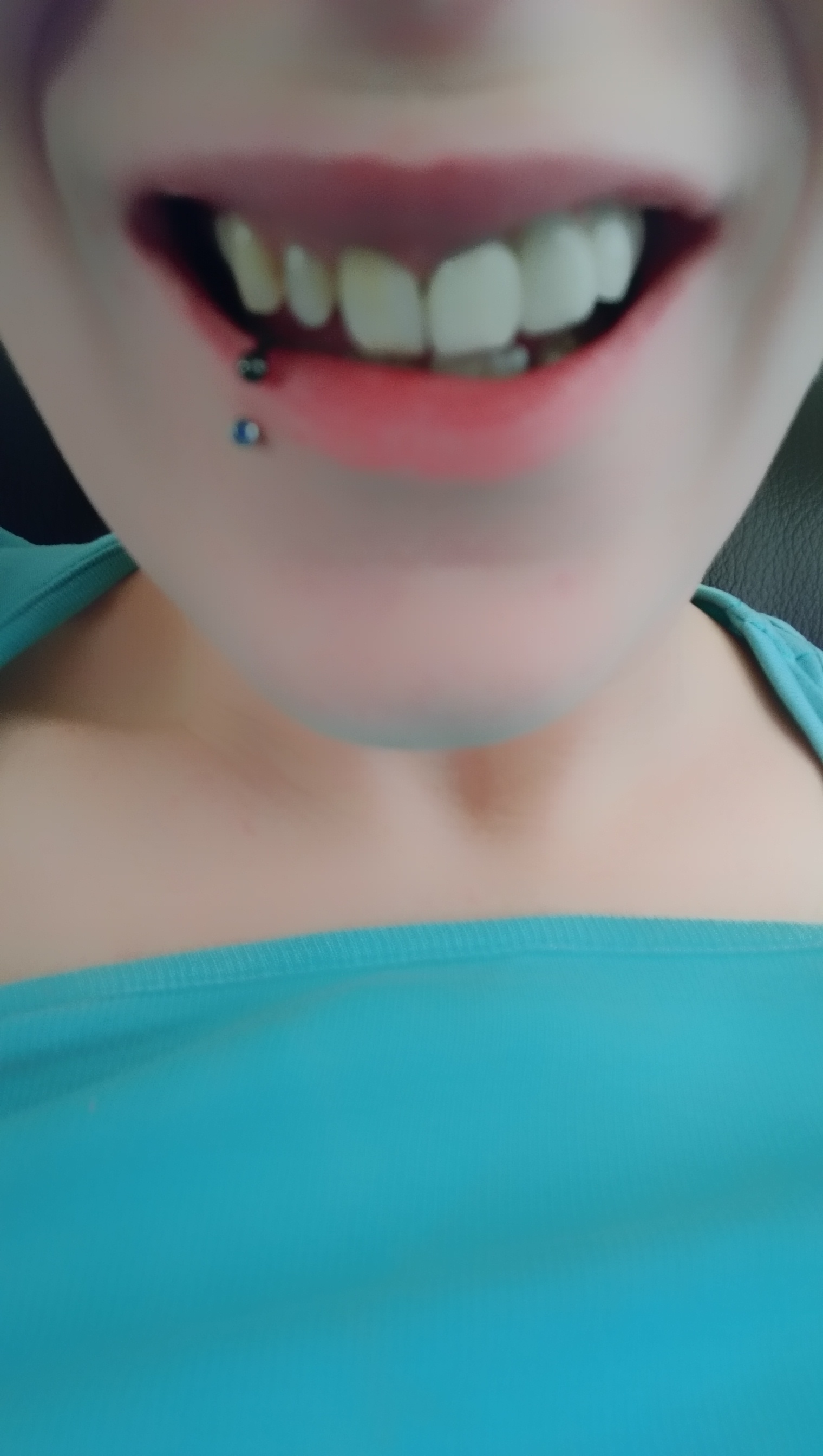 Zahnersatz Mdh Erfahrungen - Preiswerter Zahnersatz Aus Dem Ausland Langjährige Erfahrung Deutsche Qualitätsstandards Jetzt.seit Jahren Fertigt Die Mdh Ag In China Hochwertigen Zahnersatz Nach Deutschen.