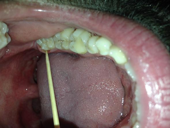 Mundhöhle - (Schmerzen, Zähne, Zahnarzt)
