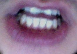 Zahn1 - (Zähne, Zahnarzt)