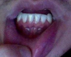 Zahn2 - (Zähne, Zahnarzt)