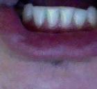 Zahn3 - (Zähne, Zahnarzt)