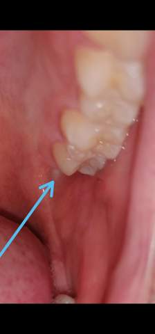 Zahnschmerzen was könnte das sein?