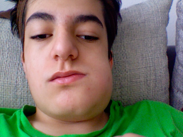 Zahnschmerzen und dicke Wange? (Zähne, Zahnmedizin)