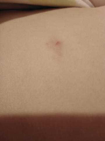 Vorter vand 10 naturlige