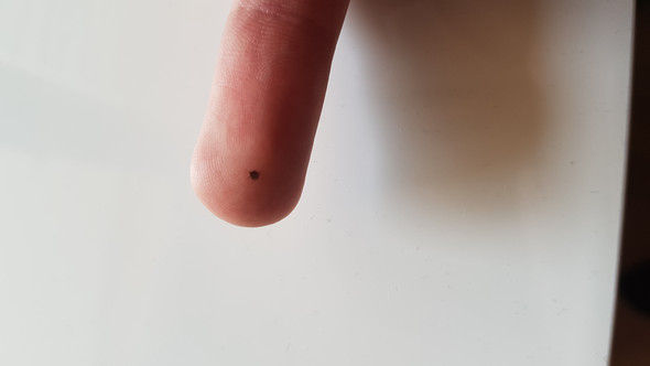 - (Insekten, Zecken, Zeckenbiss)
