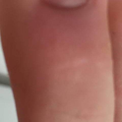 Oben sieht man einen leichten blauen Fleck und es ist leicht gerötet - (Knochen, Zeh, gebrochen..)