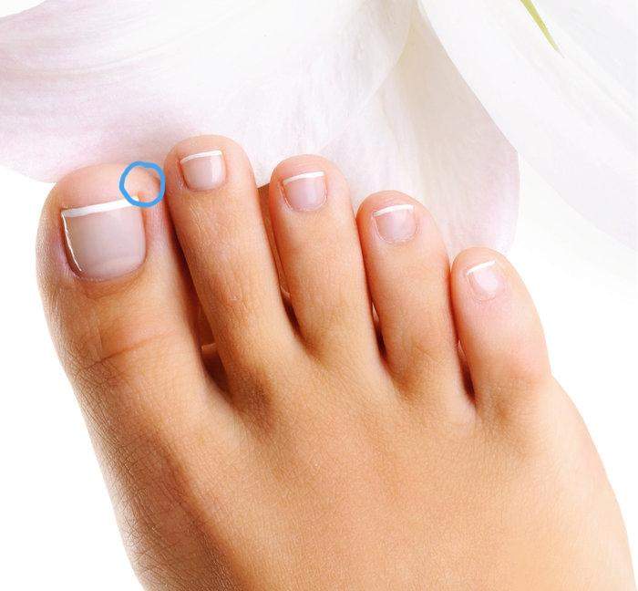 Zeh tut weh? (Gesundheit und Medizin, Gesundheit, Füße)