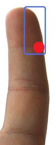 Zeigefinger Taubheitsgefühl (Medizin, Arzt, Schmerzen)