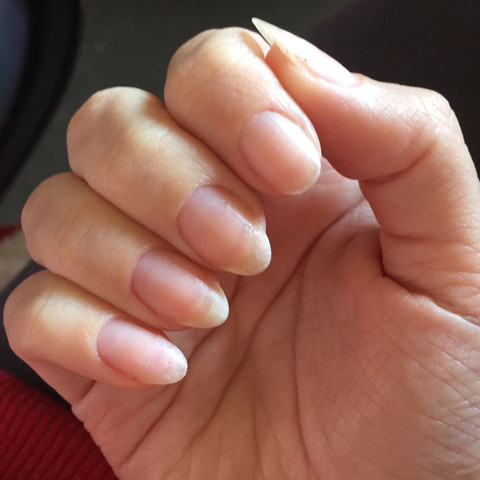 Zeigefingernagel Abgebrochen Soll Ich Meine Ganzen Nagel Abschneiden Nagellack Feile