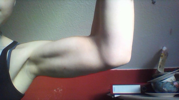 mein linker Arm - (Gesundheit, Körper, Muskeln)