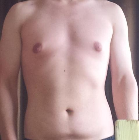 Zu Grosse Brustwarzen Als Mann Kennt Das Jemand Korper Manner Grosse Zu Grosse Brustwarzen Als Mann Kennt Das Jemand Korper Manner Grosse