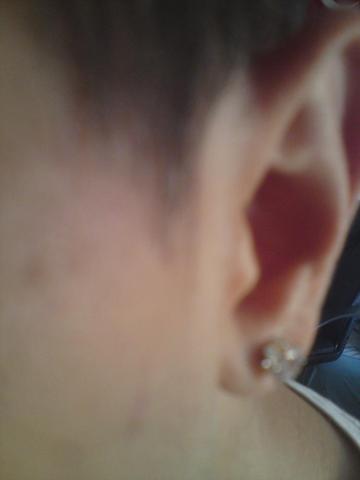Mein Ohr, Daneben der angeblich zu kleine Ohrknorpelansatz. - (Arzt, Piercing, Ohr)