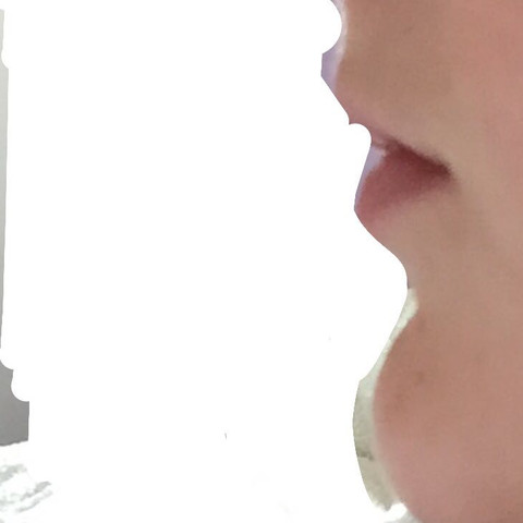 Zu Langes Kinn Hasslich Normal