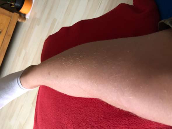 Zu Viele Armhaare Haare Beinhaare