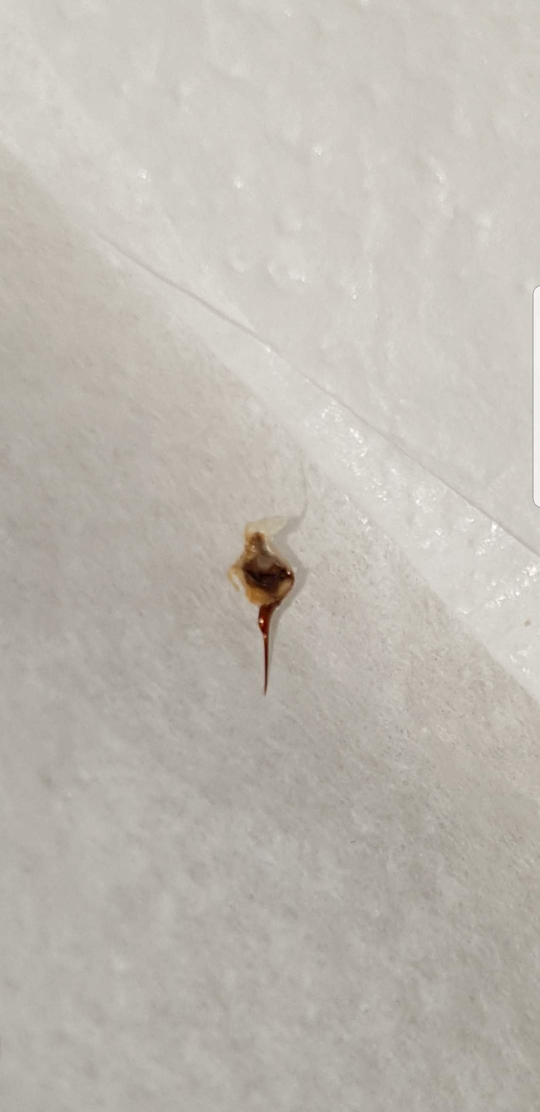 Zu welchem Tier gehört dieser stachel(giftstachel)? (Gesundheit und Medizin, Tiere, Gift)