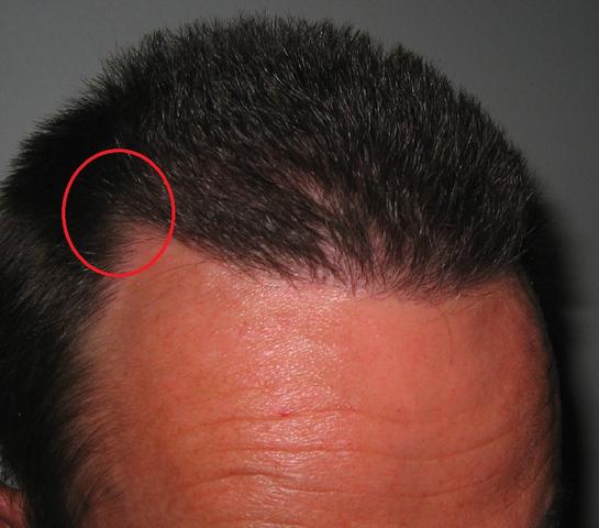 zu wenig haare an dieser stelle siehe