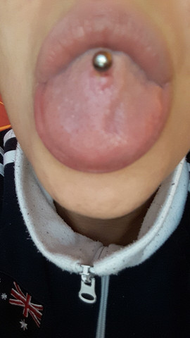 Zungenpiercing Entzundung Geht Nicht Weg Piercing Heilung Zungenpiercing Entzundung Geht Nicht Weg Piercing Heilung