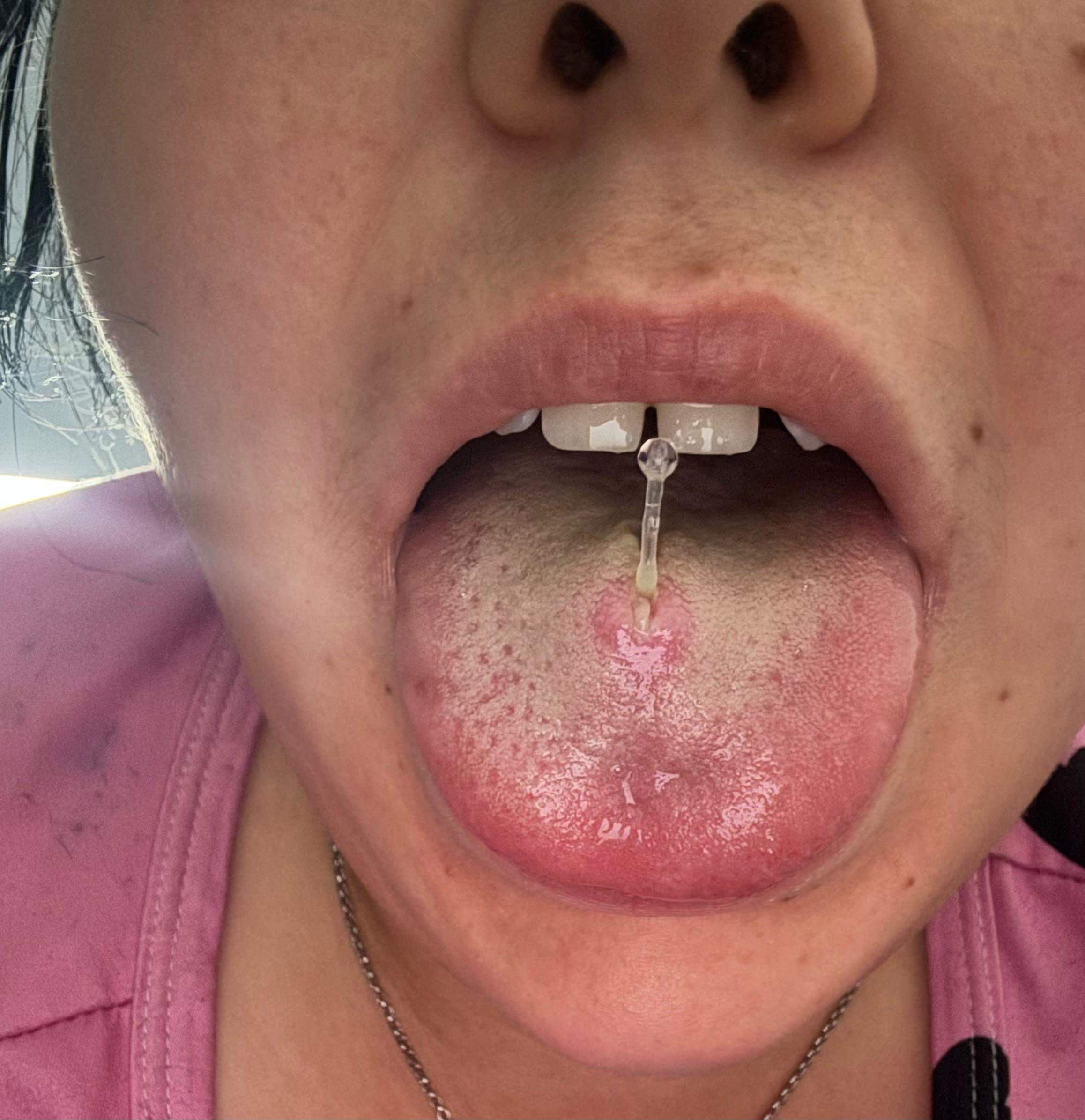 Menibeuty 10er Set Plastik Piercings - Transparente Zungen- & Brustwarzenpiercings | 14G Größe Für MRT & Alltag