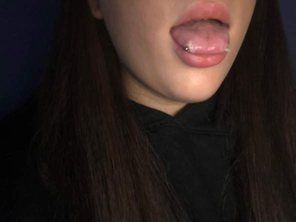 Zungenpiercing Entzundet Achtung Bild Piercing Zungenpiercing Entzundet Achtung Bild Piercing
