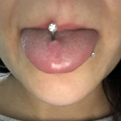Zungenpiercing Entzundet Euer Meinung Nach Piercing Entzundung Zungenpiercing Entzundet Euer Meinung Nach Piercing Entzundung