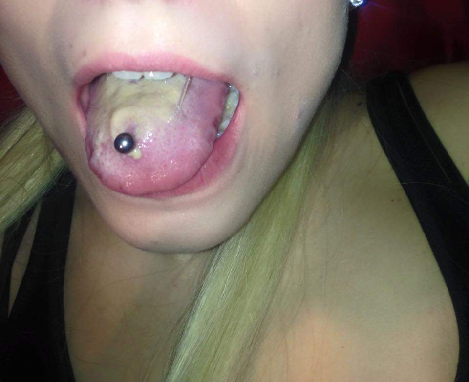 Zungenpiercing Entzundet Oder Ist Es Normal Piercing Zunge Zungenpiercing Entzundet Oder Ist Es Normal Piercing Zunge