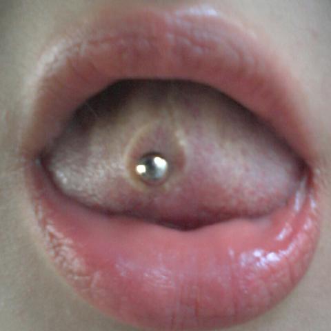 Zungenpiercing Entzundet Und Vereitert Was Tun Korper Schmerzen Piercing Zungenpiercing Entzundet Und Vereitert Was Tun Korper Schmerzen Piercing