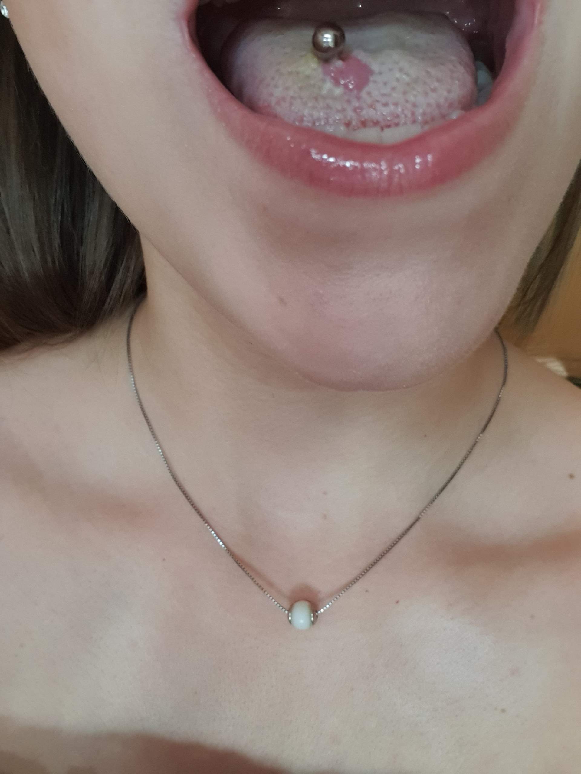 Nach Fast 20 Jahren Allergie Gegen Titan-Zungenpiercing? – RWQL