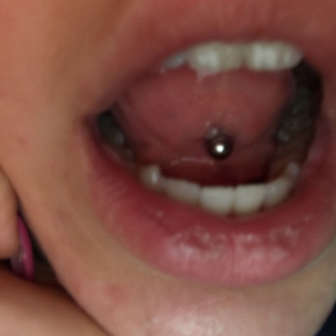 Zungenpiercing Unten Eiter Normal Schmerzen Zungenpiercing Unten Eiter Normal Schmerzen