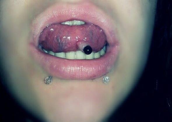 Zungenpiercing Unter Der Zunge Entzundet Piercing Entzundung Zungenpiercing Unter Der Zunge Entzundet Piercing Entzundung