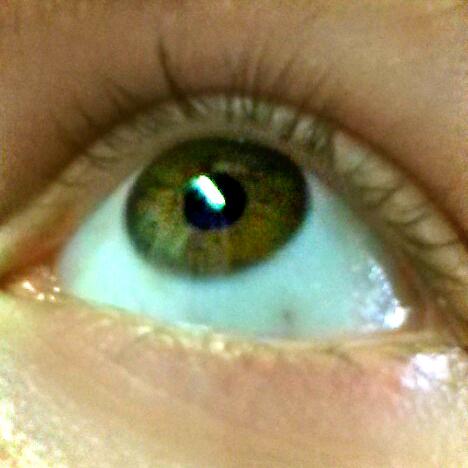 mein Auge (links) nur das hat zwei Farben. das andere ist nur braun - (Augen, Farbe)