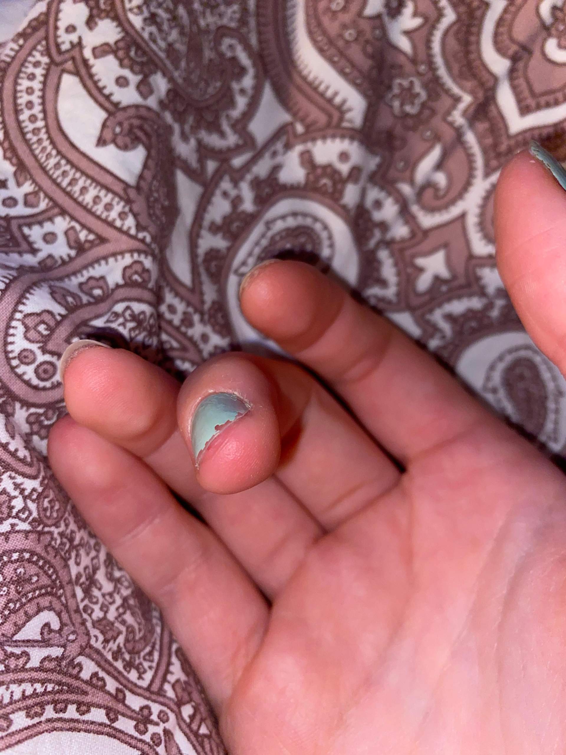 Zweiter Nagel? (Gesundheit und Medizin, Nägel, Fingernägel) Zweiter Nagel? (Gesundheit und Medizin, Nägel, Fingernägel)