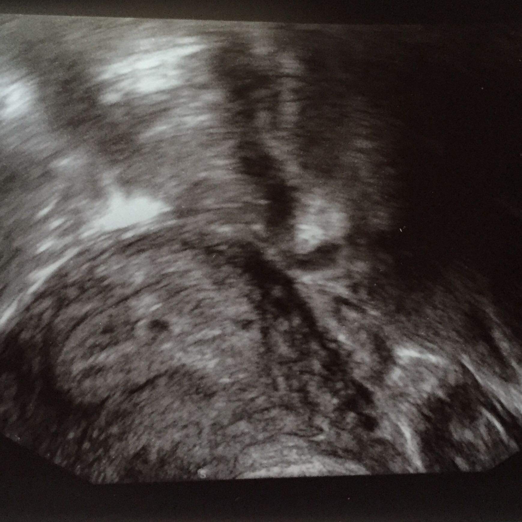 Bekomme Ich Zwillinge Oder Eins Kinder Schwangerschaft Baby Bekomme Ich Zwillinge Oder Eins Kinder Schwangerschaft Baby